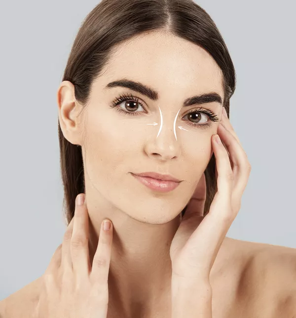 Rhinoplasty surgical procedure