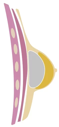 Boob Job in Mexico illustration