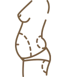Place of incisions